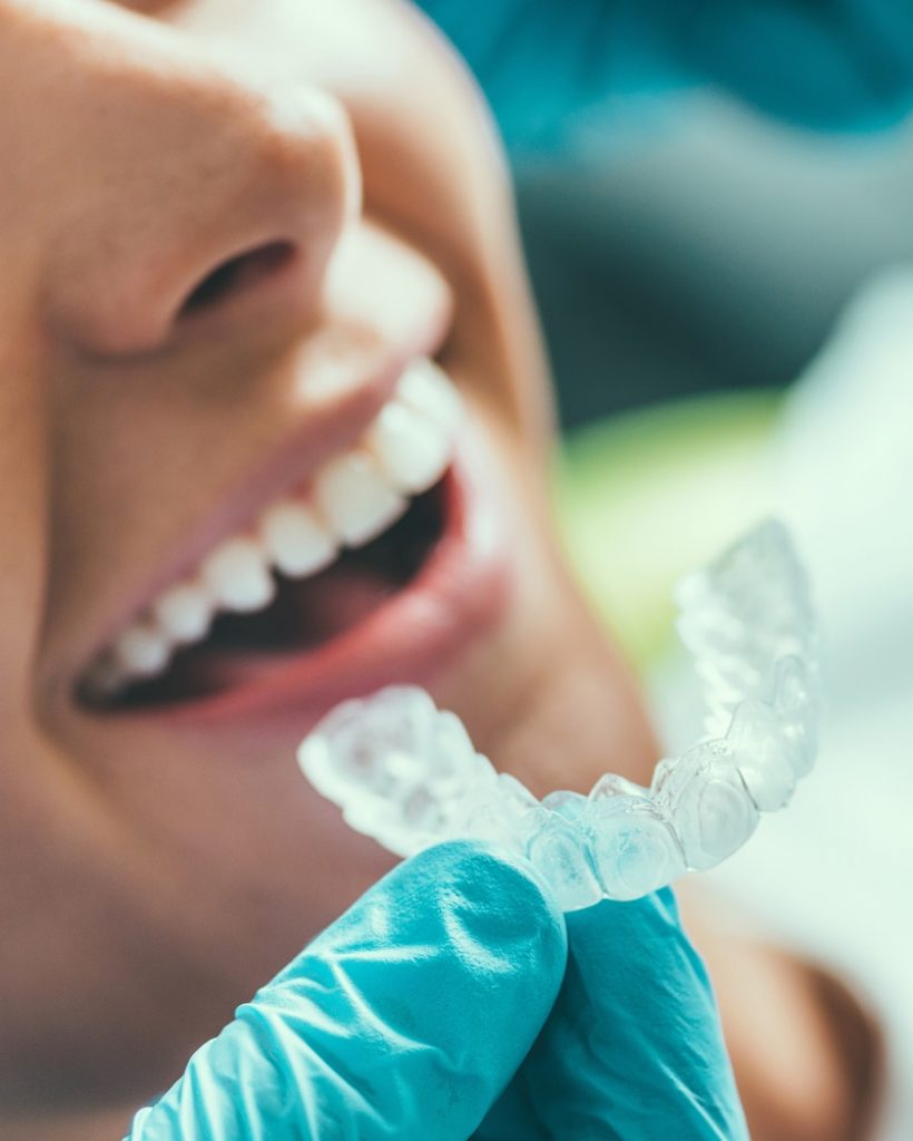 Teeth Whitening Procedure