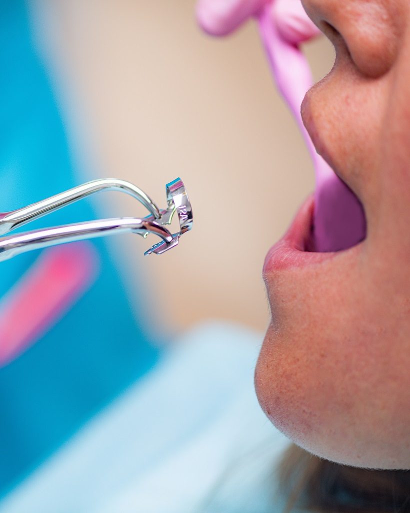 endodontie